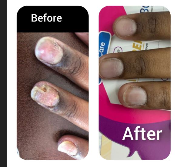 Client Before and After