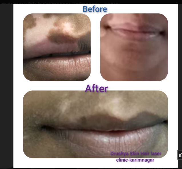 Client Before and After