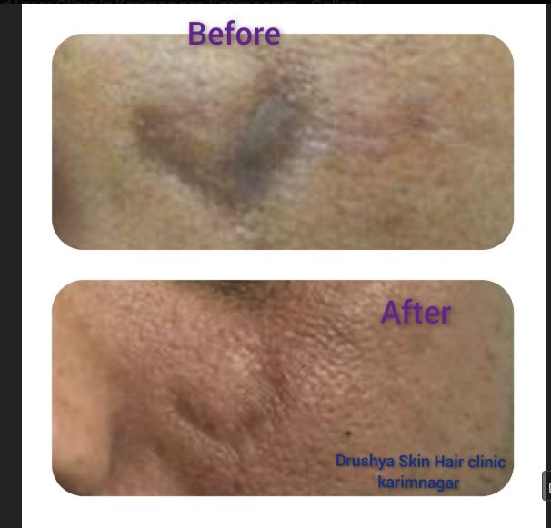 Client Before and After