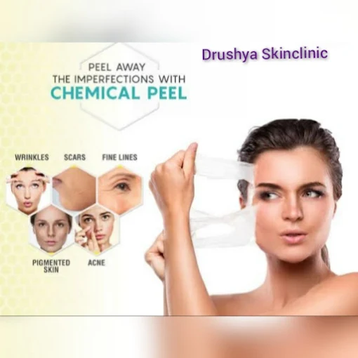 Acne Treatment Result